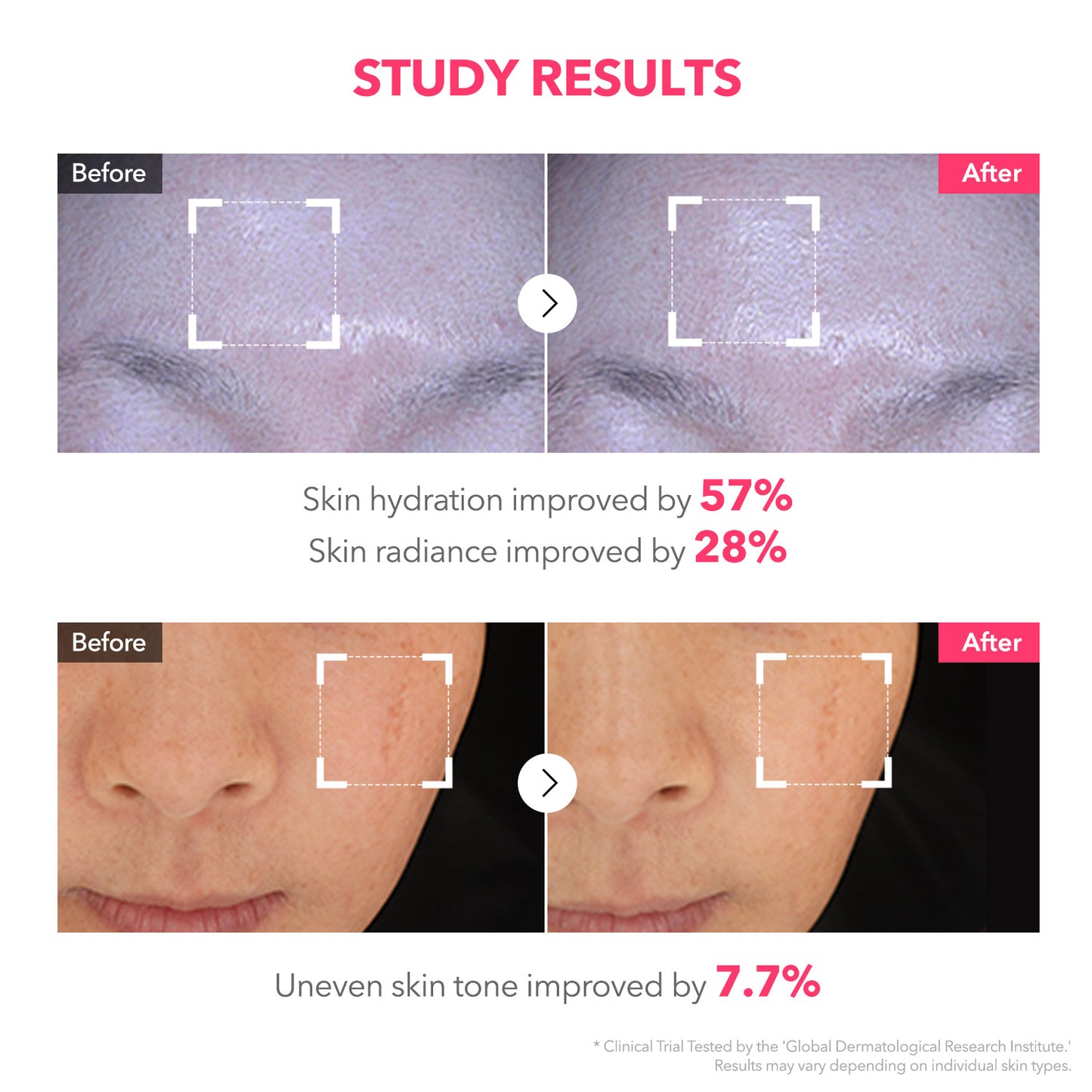 TXA Pink Capsule Overnight Gel Mask