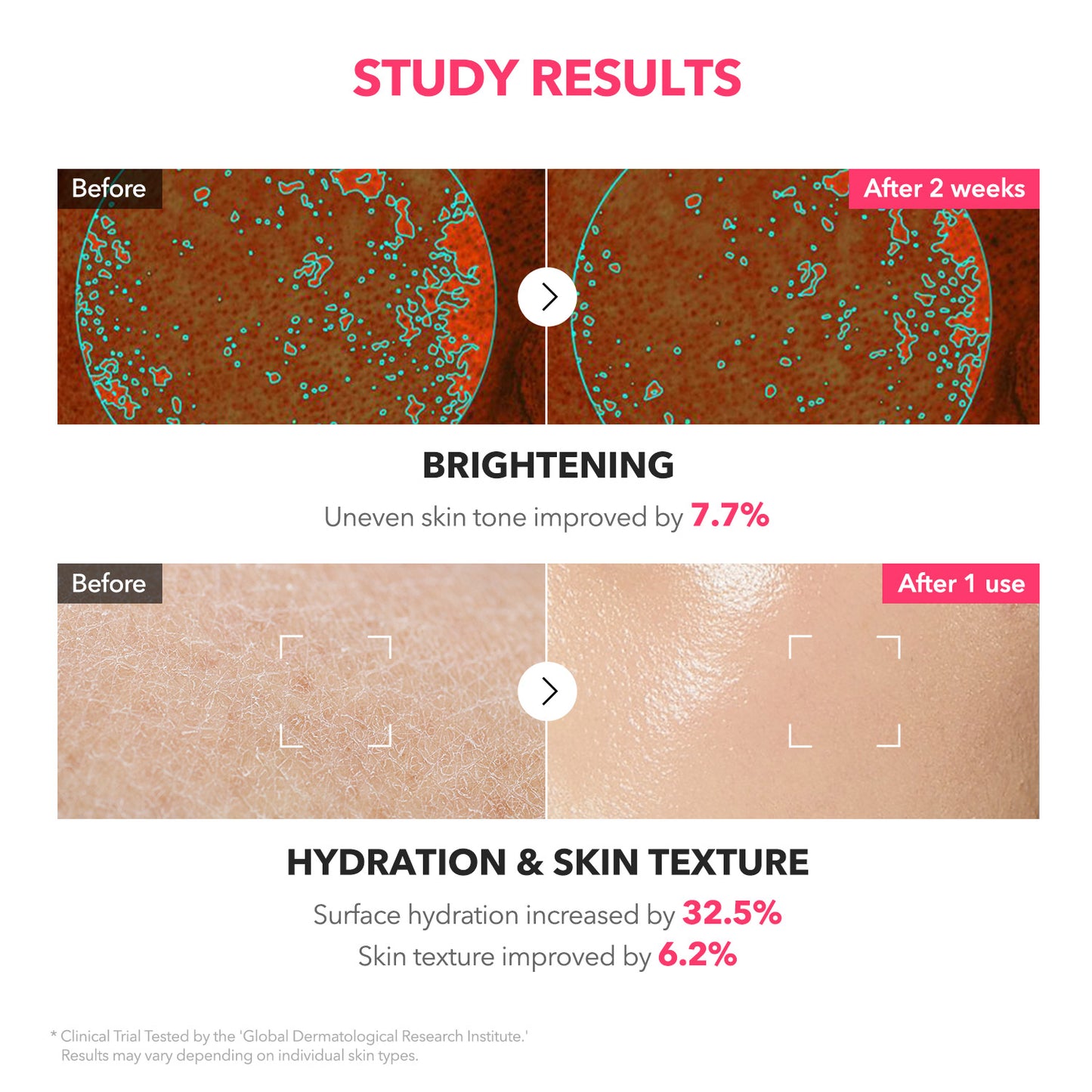 TXA+Niacinamide 99 Pink Milky Toner