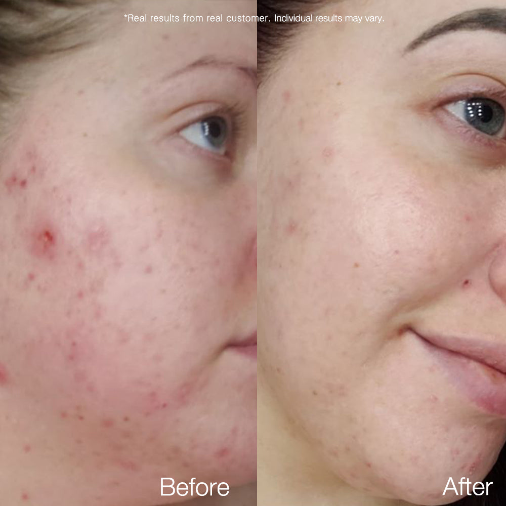 Carrotene Clarifying Serum - APRILSKIN US