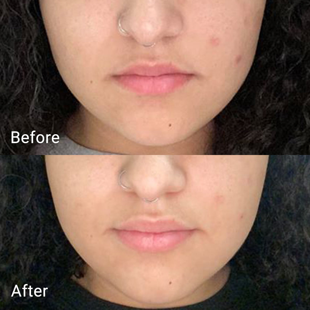 Pore-fect SET - APRILSKIN US