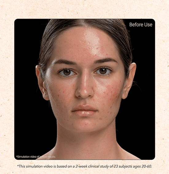 Carrotene Pimple Stopper - APRILSKIN US