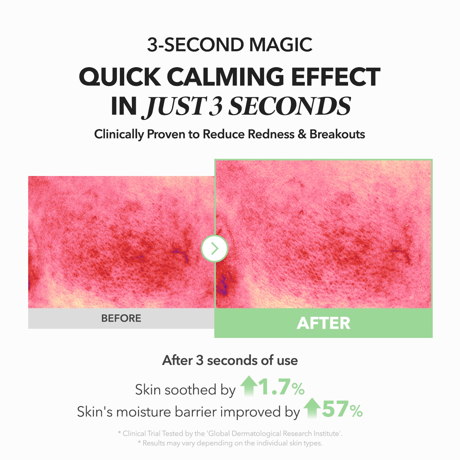 A.C.E Mugwort Centella Calming Serum - APRILSKIN US