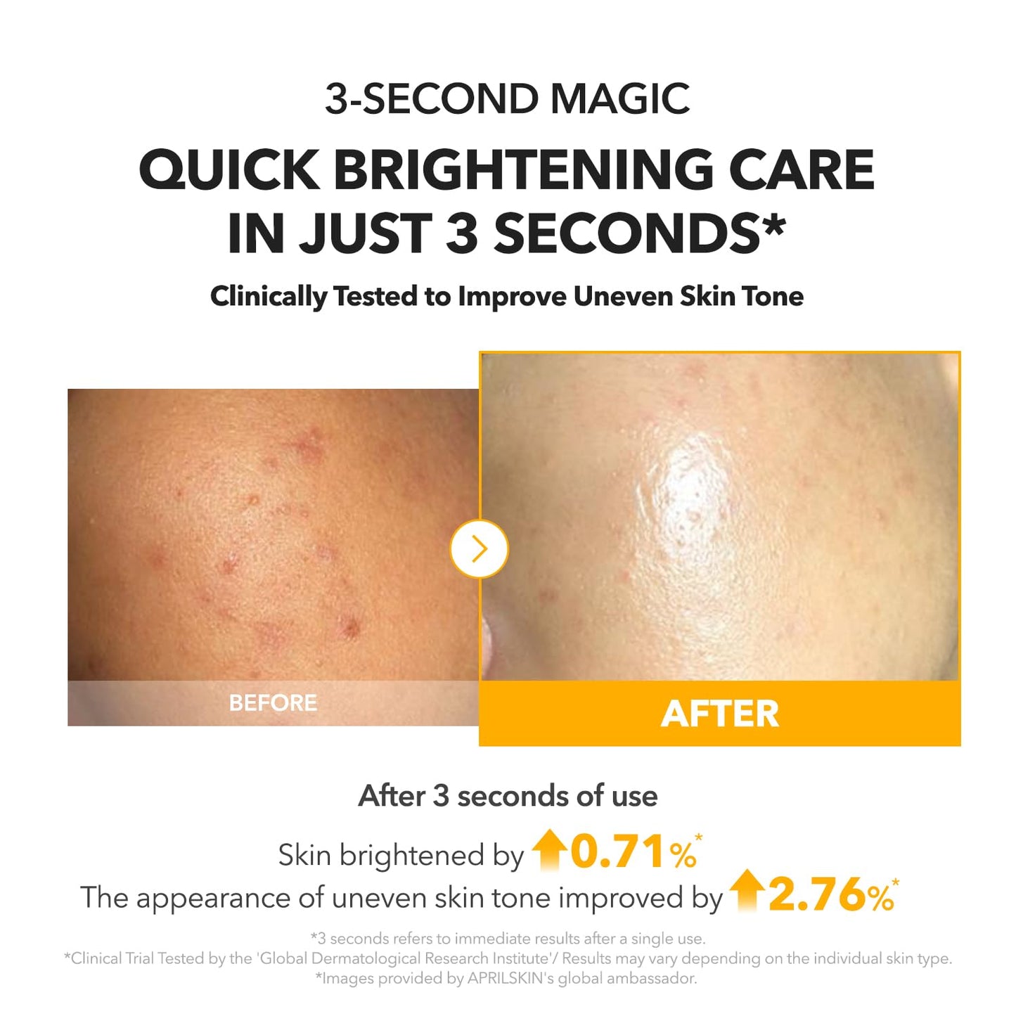 A.C.E Vita Kojic Brightening Serum - APRILSKIN US