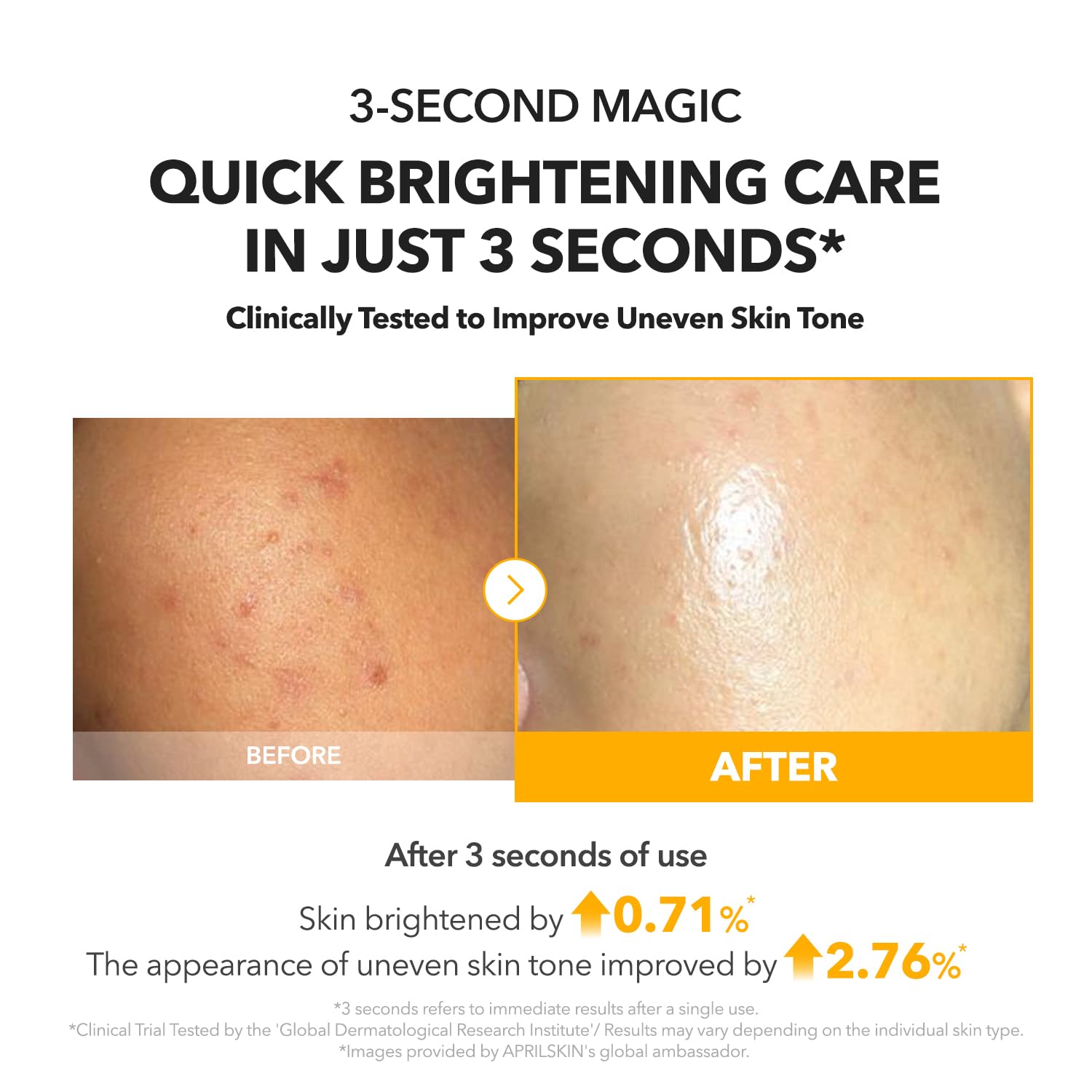 A.C.E Vita Kojic Brightening Serum - APRILSKIN US