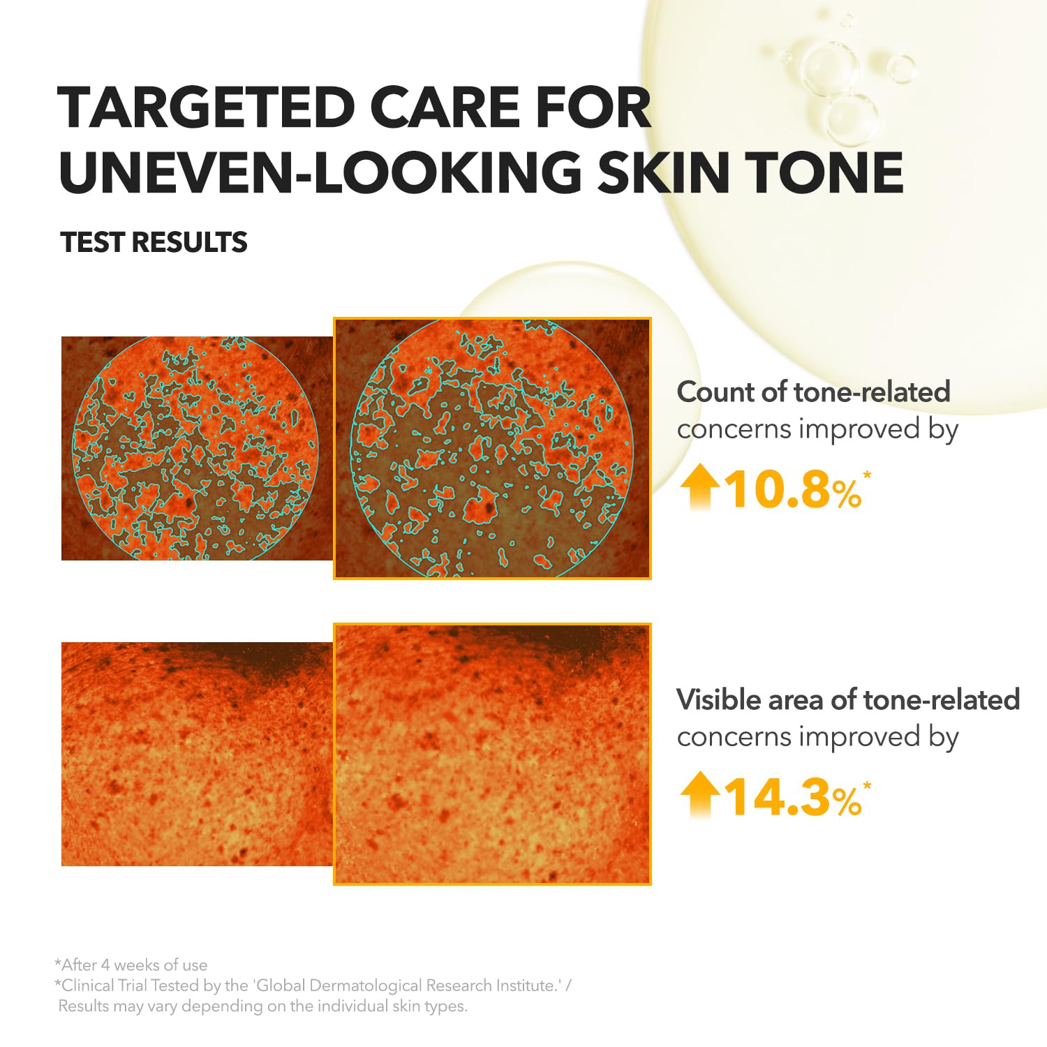 A.C.E Vita Kojic Brightening Serum - APRILSKIN US