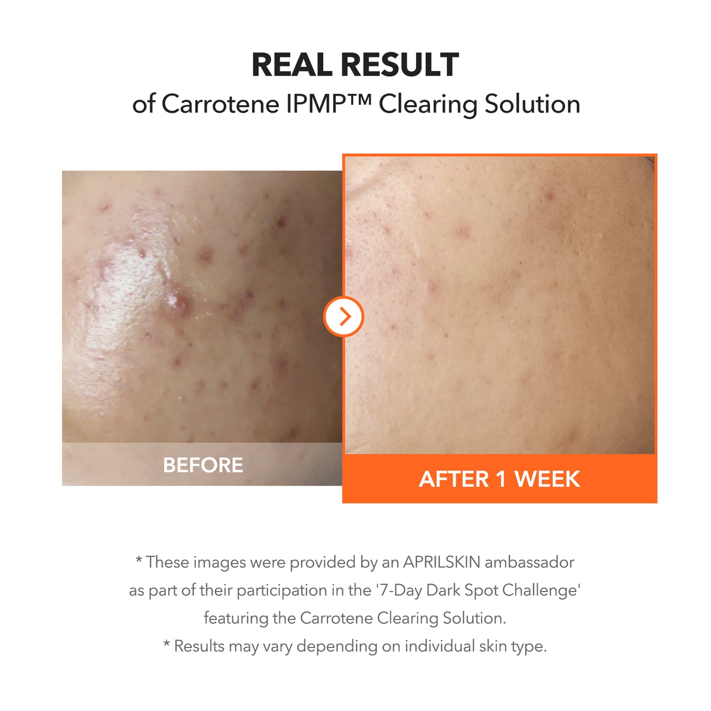 Carrotene IPMP™ Clearing Solution