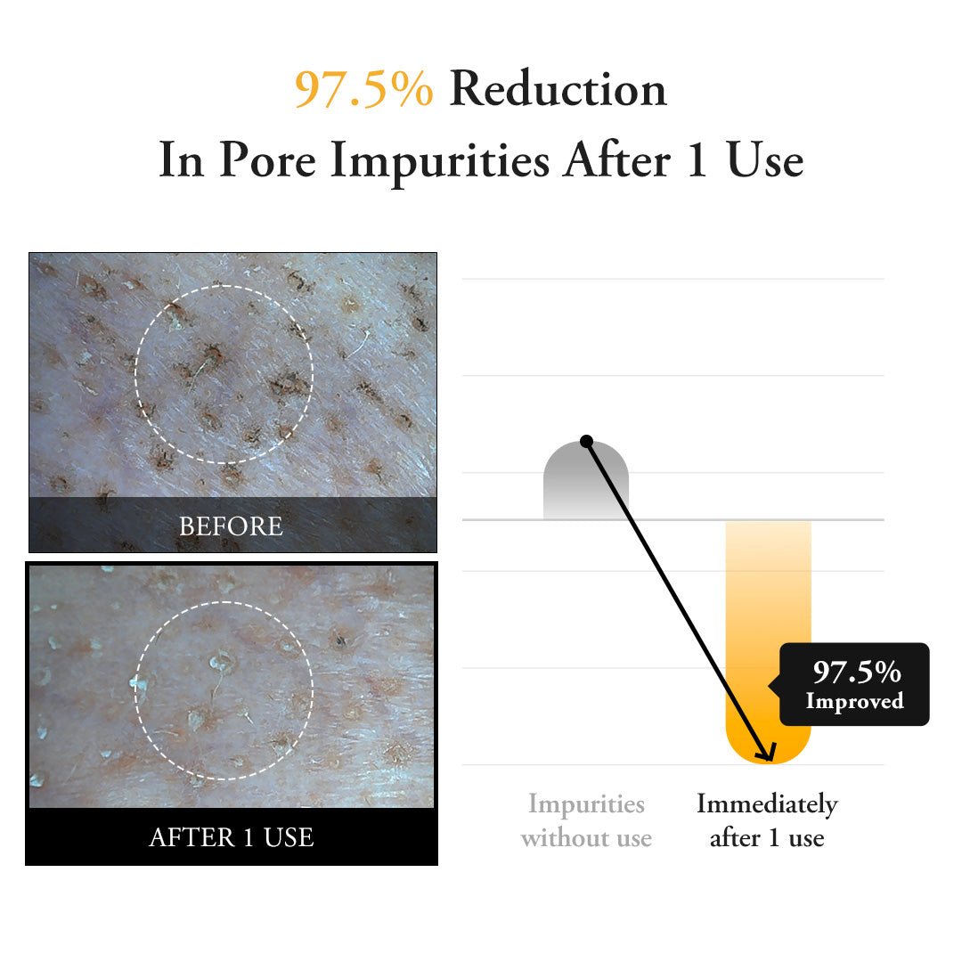 Calendula Peel Off Pack - APRILSKIN US