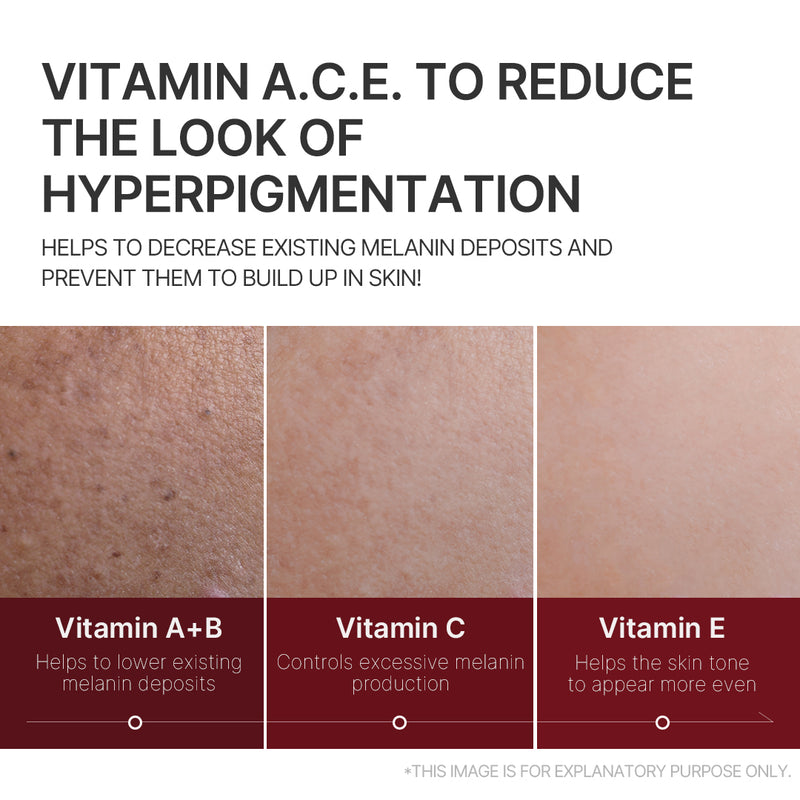 20% Vitamin A.C.E. Brightening Serum - APRILSKIN US